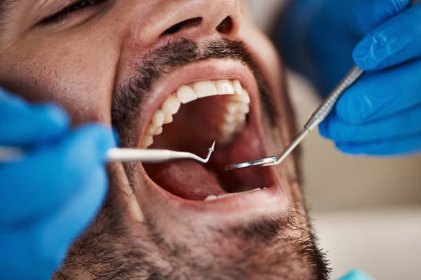 Best Pediatric Emergency Dentist in Clemmons, NC